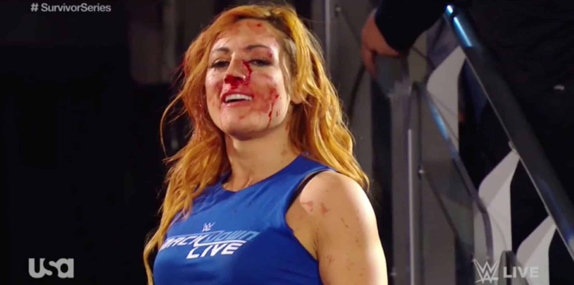 Bleeding Becky Lynch